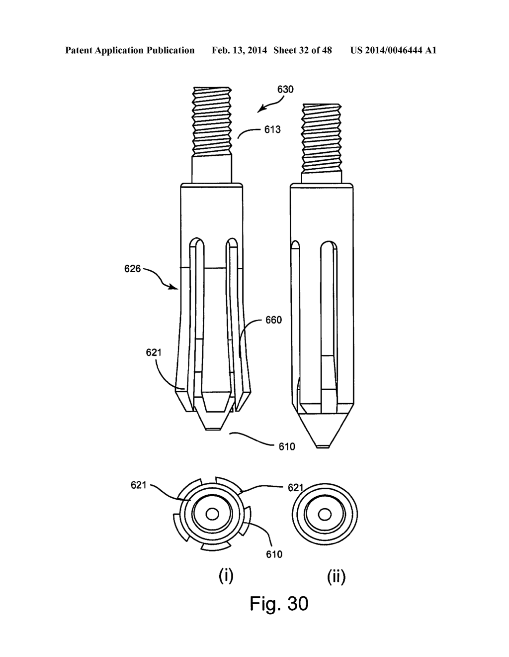 Facet Joint Replacement - diagram, schematic, and image 33