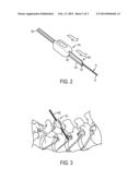 PERCUTANEOUS CAGE DELIVERY SYSTEMS DEVICES AND METHODS diagram and image