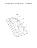 IMPLANT PACKAGE diagram and image