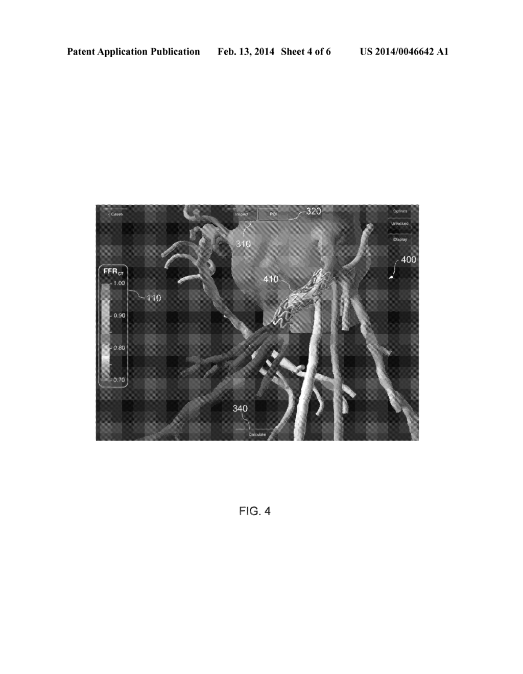 METHOD AND SYSTEM FOR PROVIDING INFORMATION FROM A PATIENT-SPECIFIC MODEL     OF BLOOD FLOW - diagram, schematic, and image 05