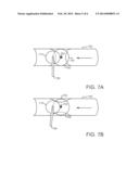 SYSTEM FOR IMPROVING ENGINE CRANKCASE VENTILATION VIA A CONDUIT diagram and image