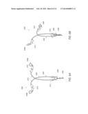 INTRAUTERINE CONTRACEPTIVE DEVICE diagram and image