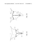 INTRAUTERINE CONTRACEPTIVE DEVICE diagram and image