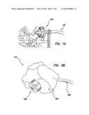 SUBSTANTIALLY CONCEALED IRRIGATION SYSTEM diagram and image