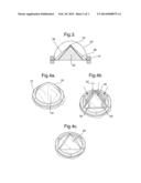 PROCESS FOR PRODUCING FORMED THERMOPLASTIC diagram and image