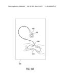 ACTIONABLE-OBJECT CONTROLLER AND DATA-ENTRY ATTACHMENT FOR TOUCHSCREEN-     BASED ELECTRONICS diagram and image