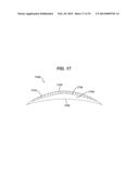 APPARATUS FOR FORMATION OF AN OPHTHALMIC LENS PRECURSOR AND LENS diagram and image