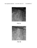 METHOD AND DEVICE FOR HIGH-RESOLUTION RETINAL IMAGING diagram and image