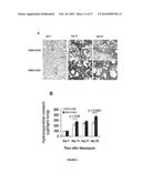 COMPOSITIONS AND METHODS FOR THE TREATMENT OF TISSUE FIBROSIS diagram and image