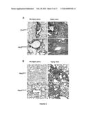 COMPOSITIONS AND METHODS FOR THE TREATMENT OF TISSUE FIBROSIS diagram and image