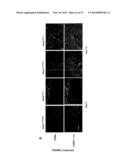 COMPOSITIONS AND METHODS FOR THE TREATMENT OF TISSUE FIBROSIS diagram and image