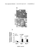 COMPOSITIONS AND METHODS FOR THE TREATMENT OF TISSUE FIBROSIS diagram and image