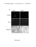 COMPOSITIONS AND METHODS FOR THE TREATMENT OF TISSUE FIBROSIS diagram and image