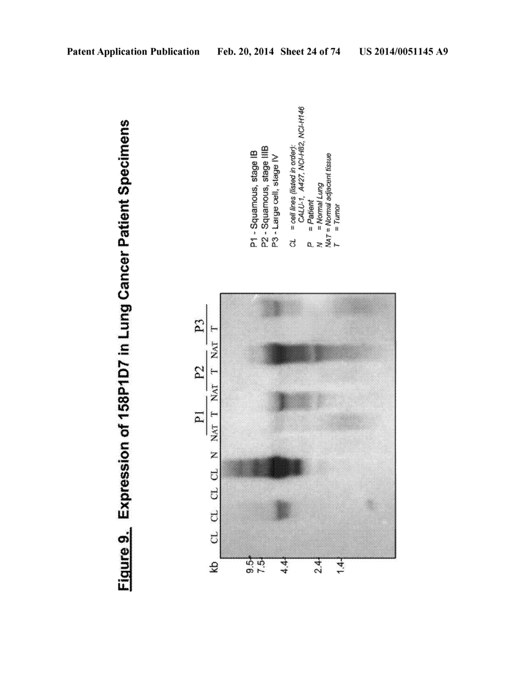 NUCLEIC ACID AND CORRESPONDING PROTEIN NAMED 158P1D7 USEFUL IN THE     TREATMENT AND DETECTION OF BLADDER AND OTHER CANCERS - diagram, schematic, and image 25