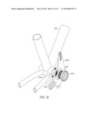 CHAIN GUARD WITH UNITARY BRACKET EXTENSION diagram and image