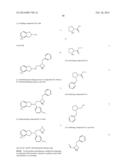 Use of Aminoindane Compounds in Treating Overactive Bladder and     Interstitial Cystitis diagram and image