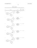 Use of Aminoindane Compounds in Treating Overactive Bladder and     Interstitial Cystitis diagram and image