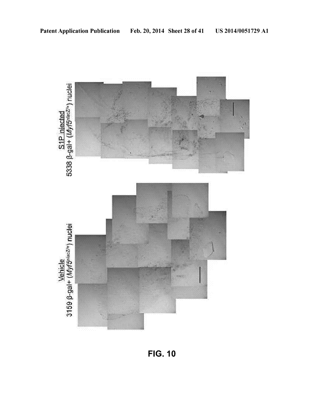 COMPOSITIONS AND METHODS FOR TREATING DEGENERATIVE MUSCLE CONDITIONS - diagram, schematic, and image 29