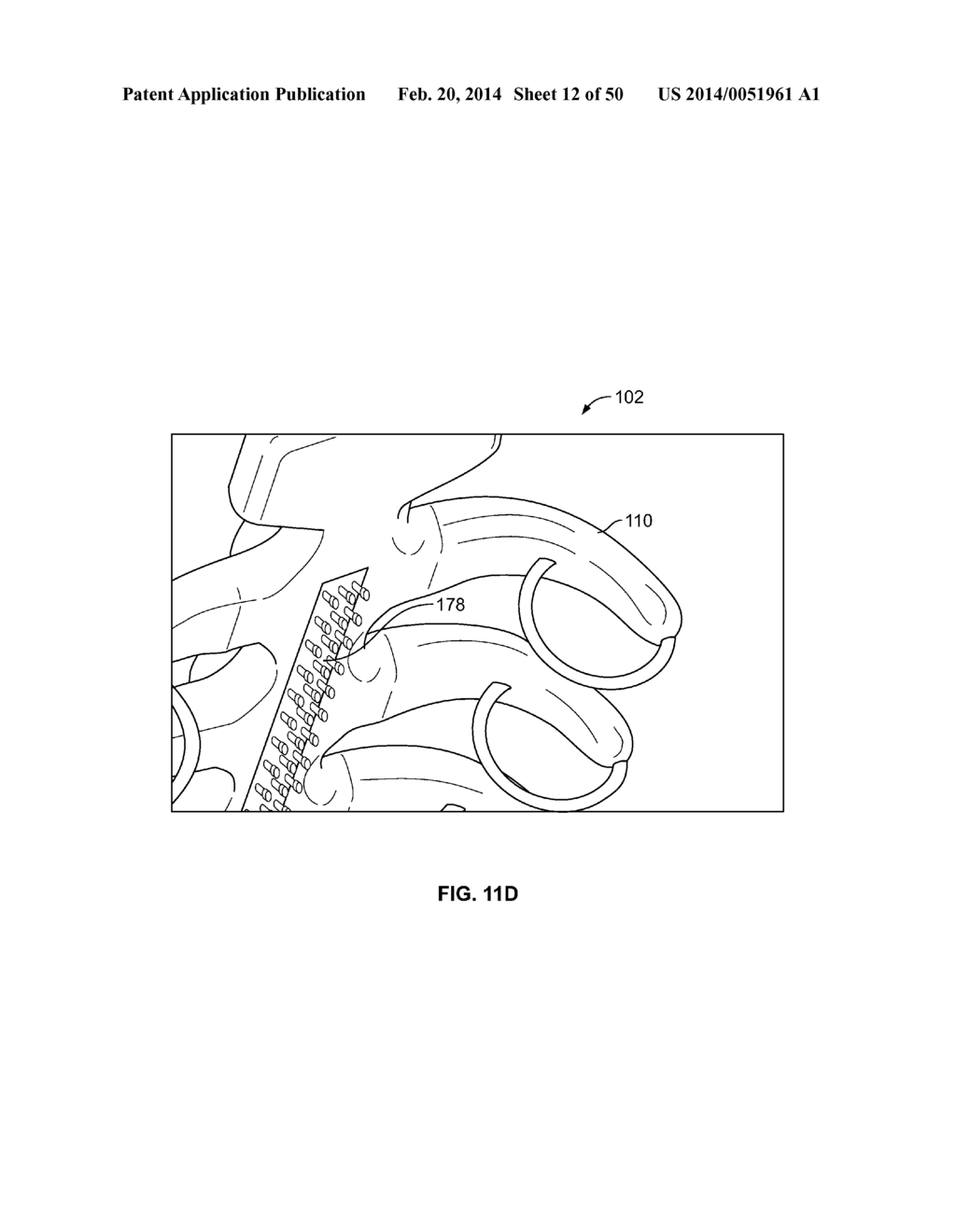 SYSTEMS AND METHODS TO GATHER AND ANALYZE ELECTROENCEPHALOGRAPHIC DATA - diagram, schematic, and image 13