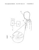 METHOD AND APPARATUS FOR DIAGNOSIS OF TUMOR ACTIVITY USING TUMOR     INTERSTITIAL FLUID PRESSURE diagram and image