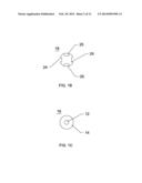 METHOD & APPARATUS FOR SOLID ORGAN TISSUE APPROXIMATION diagram and image