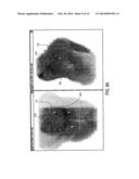 LOCALIZATION OF A TARGET USING IN VIVO MARKERS diagram and image