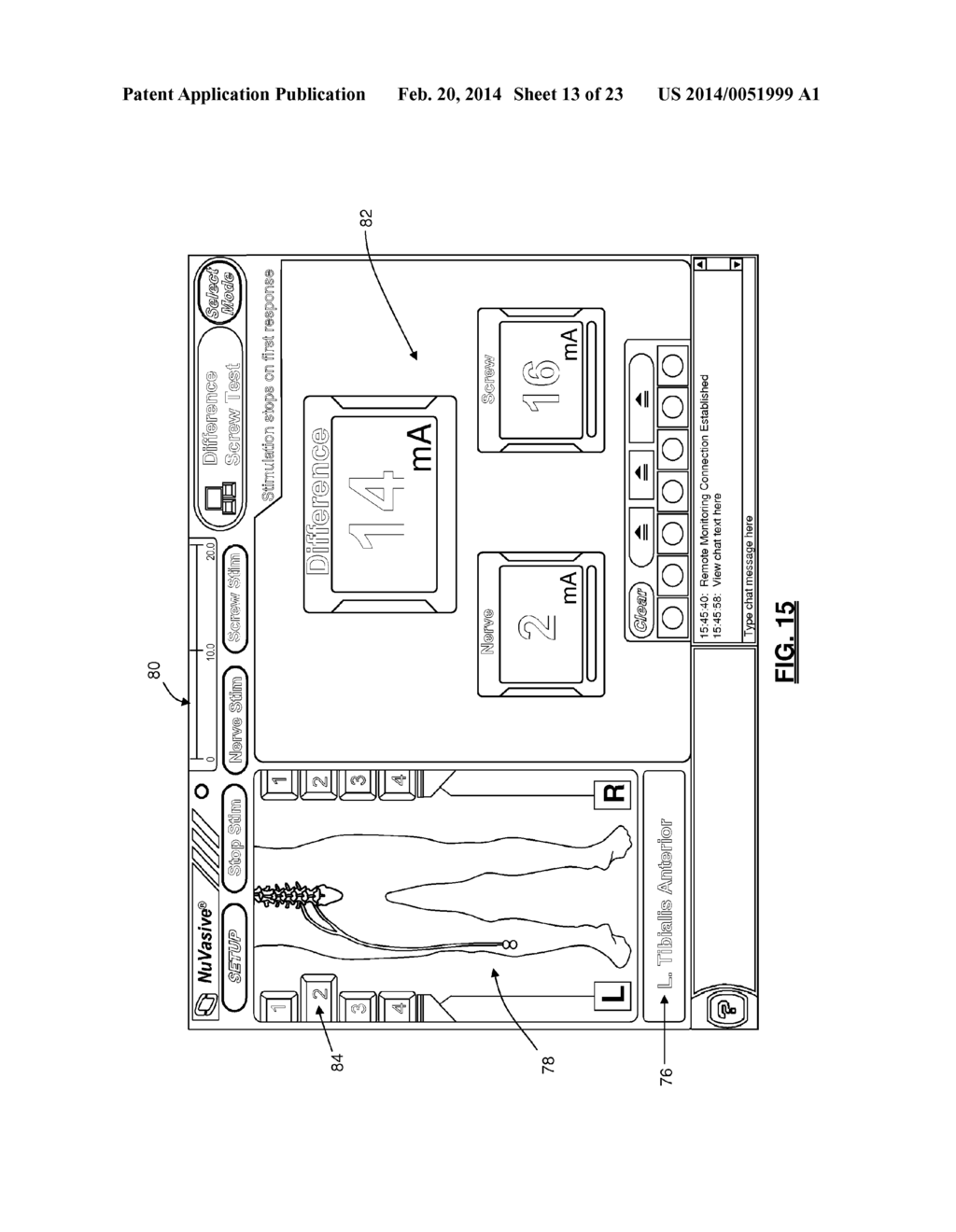 System and Methods for Nerve Monitoring - diagram, schematic, and image 14