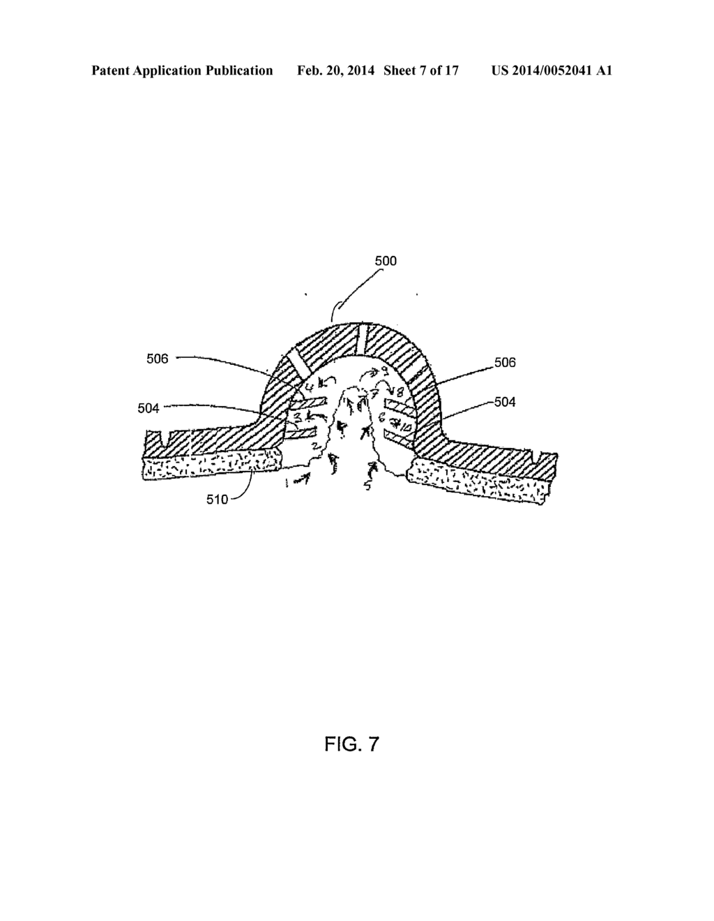 MEDICAL PROTRUDED PADS OR DRESSINGS FOR WOUND CARE INCLUDING USE WITH     ORTHOPEDIC AND PROSTHETIC DEVICES - diagram, schematic, and image 08