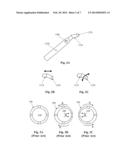 Infusion Sleeve with Motion Reduction Profile diagram and image