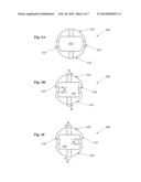 Infusion Sleeve with Motion Reduction Profile diagram and image