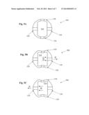 Infusion Sleeve with Motion Reduction Profile diagram and image