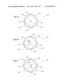 Infusion Sleeve with Motion Reduction Profile diagram and image