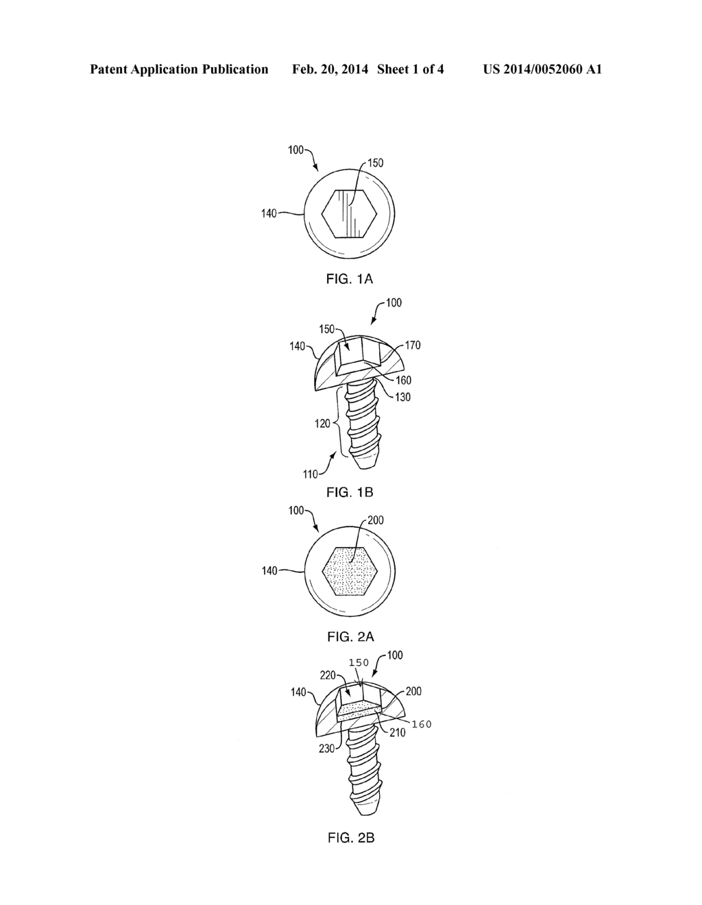 Drug Eluting Surgical Screw - diagram, schematic, and image 02