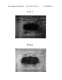 ABSORBENT ARTICLE diagram and image