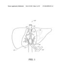 HEPATIC NEUROMODULATION METHODS diagram and image