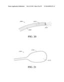 HEPATIC NEUROMODULATION METHODS diagram and image