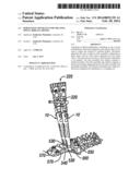 Derotation Apparatus for Treating Spinal Irregularities diagram and image