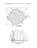 RETRIEVAL DEVICE diagram and image