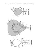 RETRIEVAL DEVICE diagram and image