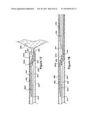 RETRIEVAL DEVICE diagram and image