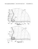 RETRIEVAL DEVICE diagram and image