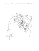 VAGINAL MANIPULATOR HEAD WITH TISSUE INDEX AND HEAD EXTENDER diagram and image