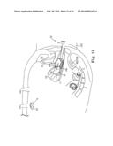 VAGINAL MANIPULATOR HEAD WITH TISSUE INDEX AND HEAD EXTENDER diagram and image