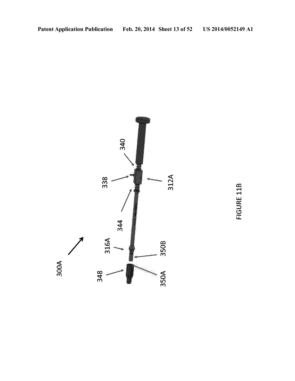 HIP REPLACEMENT NAVIGATION SYSTEM AND METHOD - diagram, schematic, and image 14