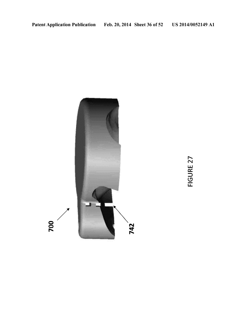 HIP REPLACEMENT NAVIGATION SYSTEM AND METHOD - diagram, schematic, and image 37