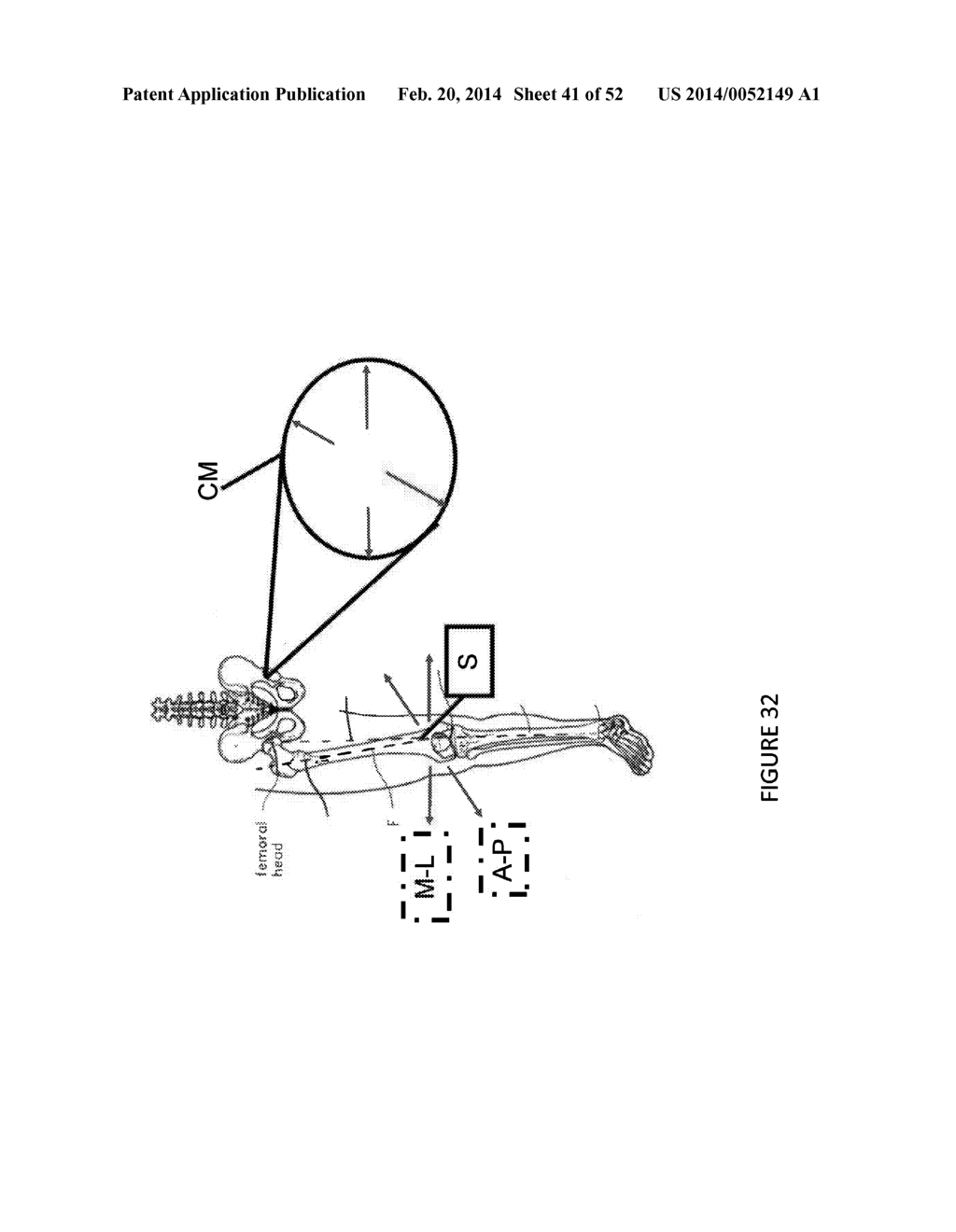 HIP REPLACEMENT NAVIGATION SYSTEM AND METHOD - diagram, schematic, and image 42