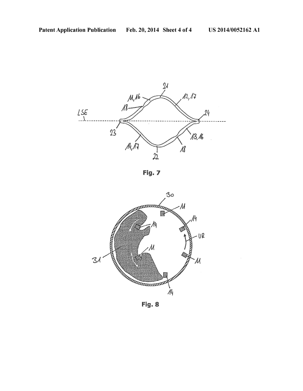 MEDICAL DEVICE HAVING A LATTICE STRUCTURE AND TREATMENT SYSTEM HAVING SUCH     A LATTICE STRUCTURE - diagram, schematic, and image 05