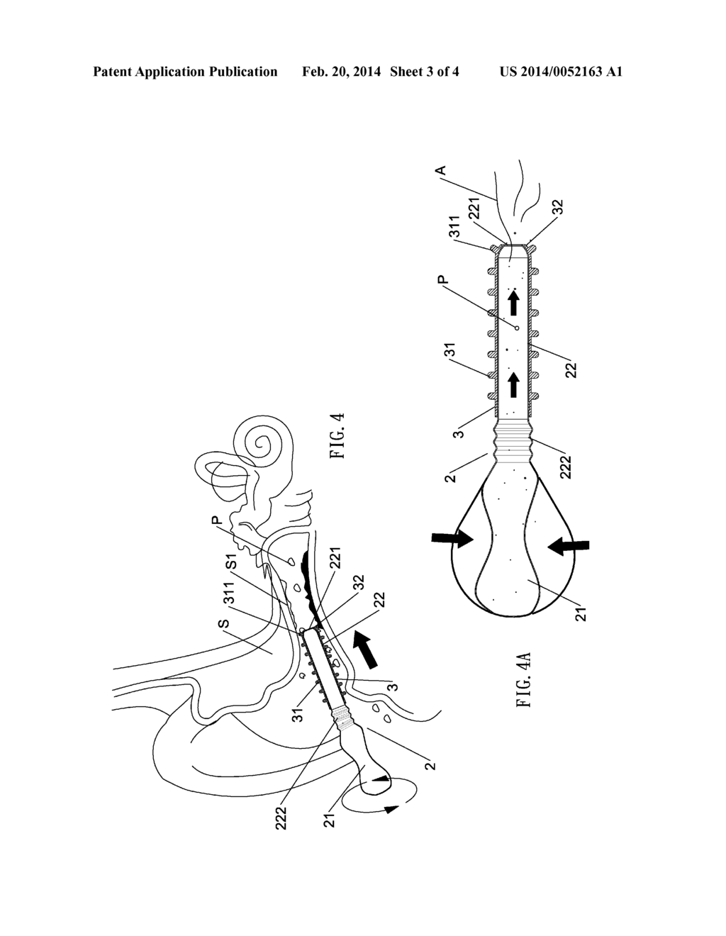 EARWAX CLEANER - diagram, schematic, and image 04