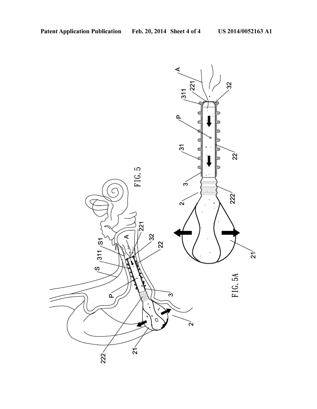 EARWAX CLEANER - diagram, schematic, and image 05