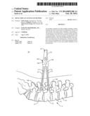 SPINAL IMPLANT SYSTEM AND METHOD diagram and image